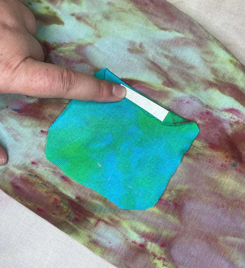 Image of Patch Fixation Step 4